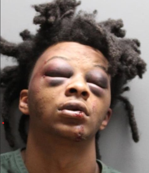 Mugshot after beating